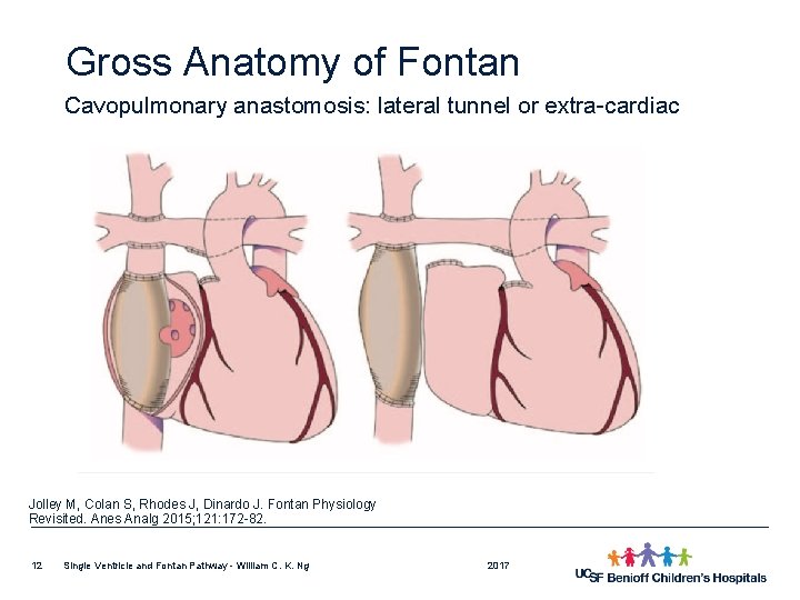 Gross Anatomy of Fontan Cavopulmonary anastomosis: lateral tunnel or extra-cardiac Jolley M, Colan S,