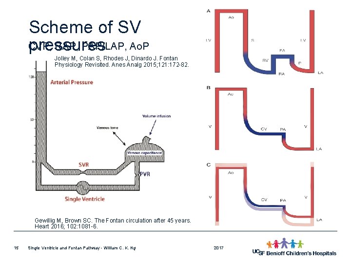 Scheme of SV CVP, RAP, PAP/LAP, Ao. P pressures Jolley M, Colan S, Rhodes