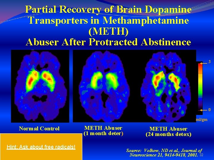 Partial Recovery of Brain Dopamine Transporters in Methamphetamine (METH) Abuser After Protracted Abstinence 3