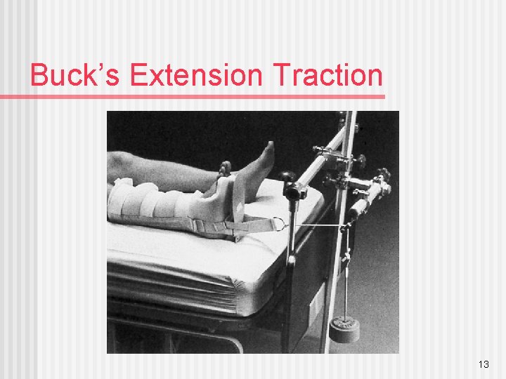 Buck’s Extension Traction 13 