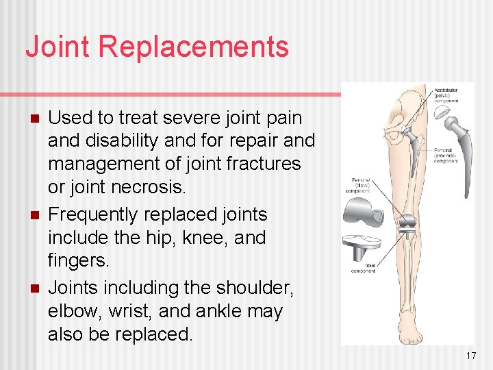 Joint Replacements n n n Used to treat severe joint pain and disability and
