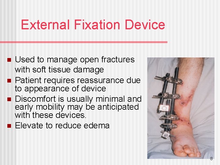External Fixation Device n n Used to manage open fractures with soft tissue damage
