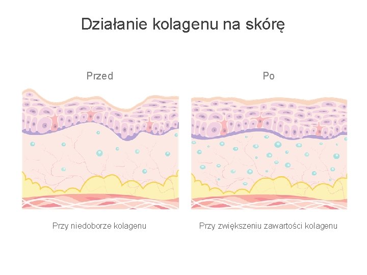 Działanie kolagenu na skórę Przed Po Przy niedoborze kolagenu Przy zwiększeniu zawartości kolagenu 