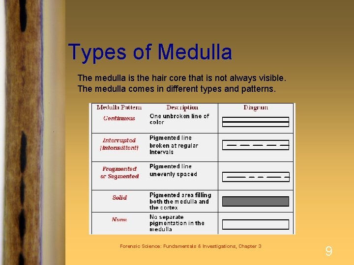 Types of Medulla The medulla is the hair core that is not always visible.