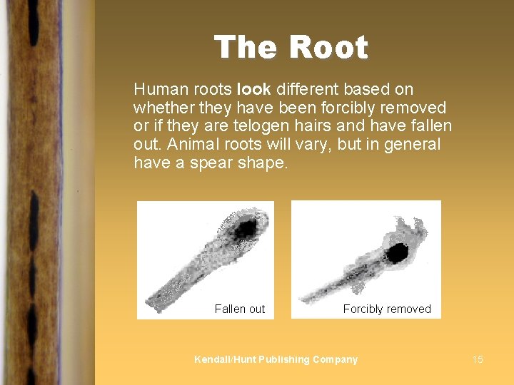 The Root Human roots look different based on whether they have been forcibly removed