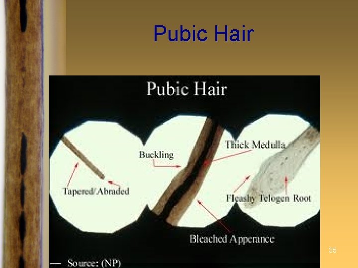 Pubic Hair Forensic Science: Fundamentals & Investigations, Chapter 3 35 