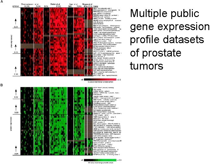 Multiple public gene expression profile datasets of prostate tumors 