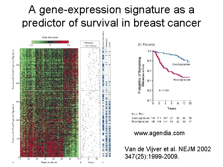 A gene-expression signature as a predictor of survival in breast cancer www. agendia. com