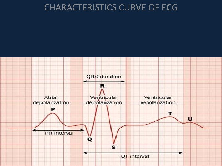 CHARACTERISTICS CURVE OF ECG 