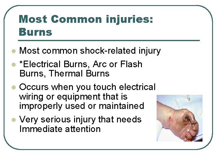 Most Common injuries: Burns l l Most common shock-related injury *Electrical Burns, Arc or Most Common injuries: Burns l l Most common shock-related injury *Electrical Burns, Arc or