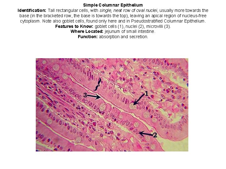 Simple Columnar Epithelium Identification: Tall rectangular cells, with single, neat row of oval nuclei,