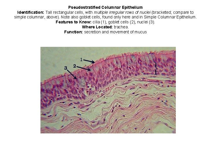 Pseudostratified Columnar Epithelium Identification: Tall rectangular cells, with multiple irregular rows of nuclei (bracketed;