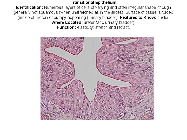 Transitional Epithelium Identification: Numerous layers of cells of varying and often irregular shape, though