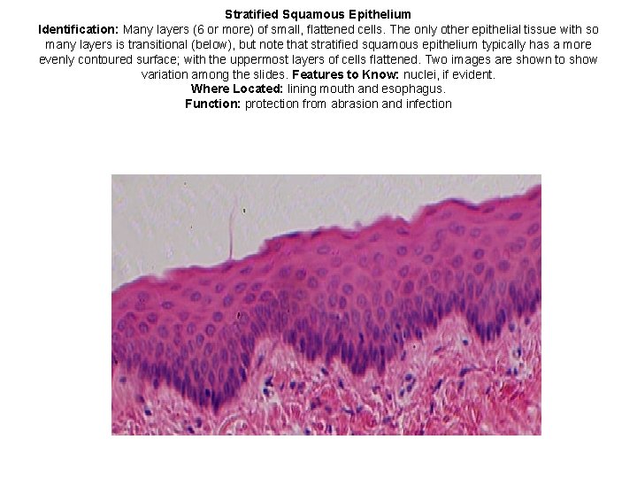 Stratified Squamous Epithelium Identification: Many layers (6 or more) of small, flattened cells. The