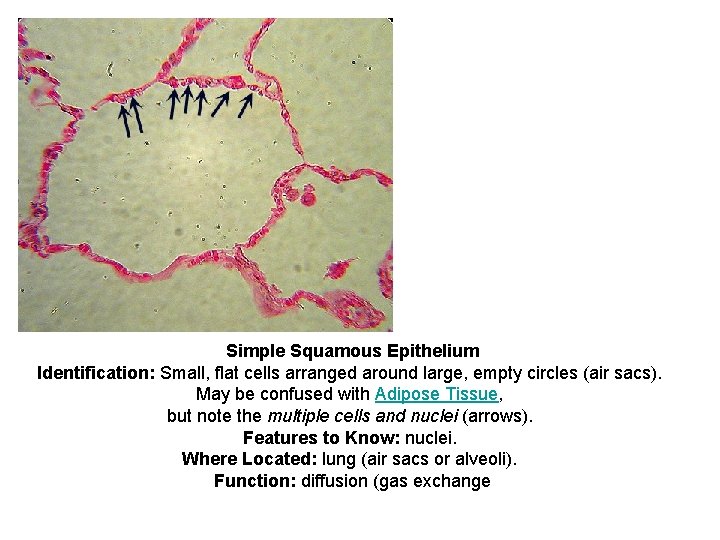 Simple Squamous Epithelium Identification: Small, flat cells arranged around large, empty circles (air sacs).