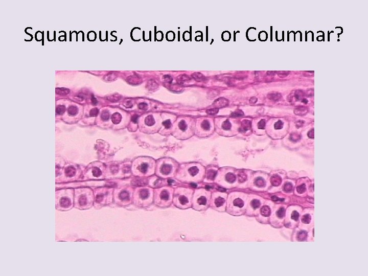 Squamous, Cuboidal, or Columnar? 