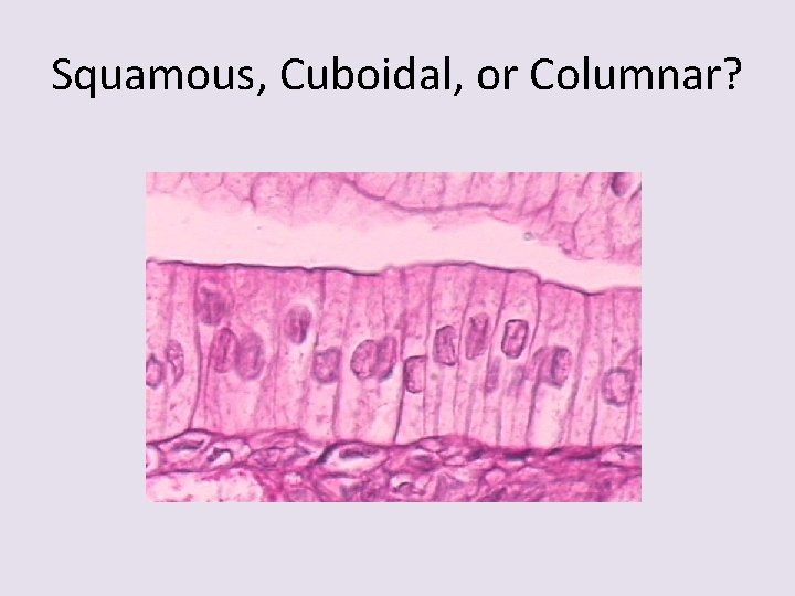 Squamous, Cuboidal, or Columnar? 