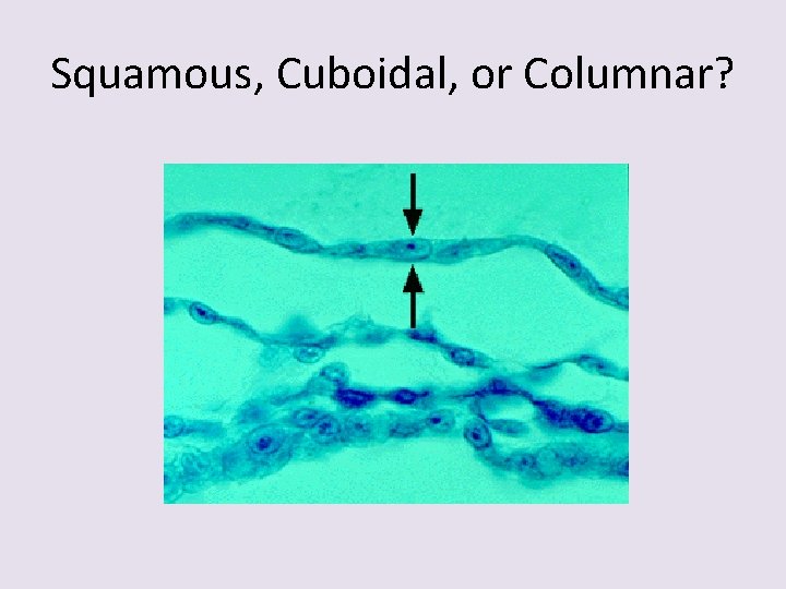 Squamous, Cuboidal, or Columnar? 