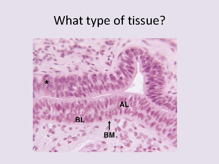 What type of tissue? 