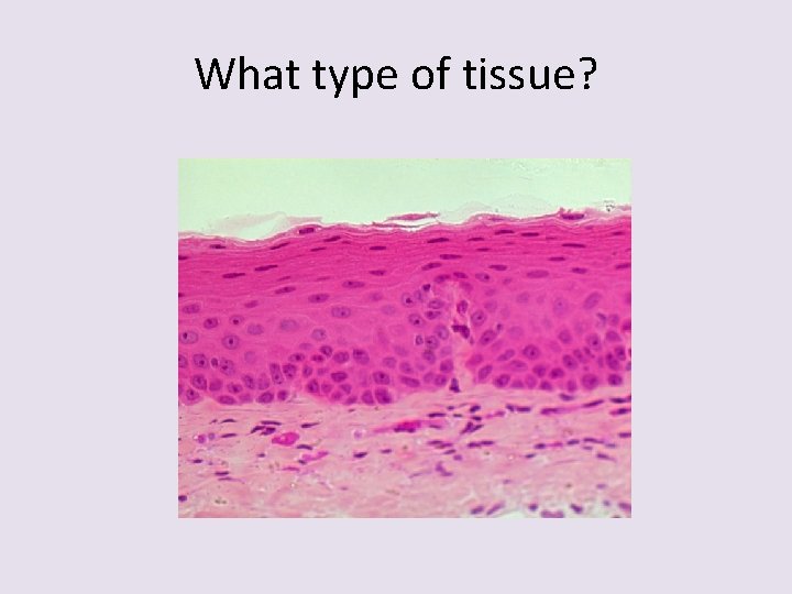 What type of tissue? 