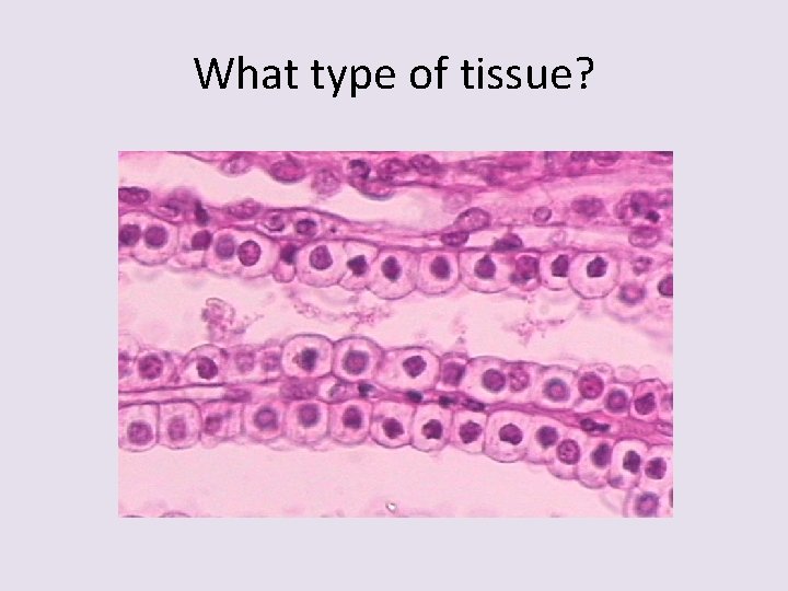 What type of tissue? 