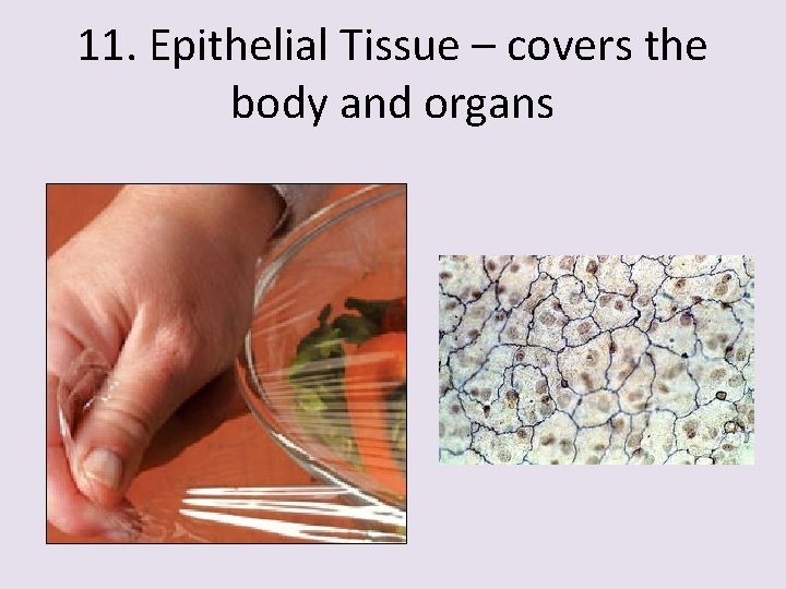 11. Epithelial Tissue – covers the body and organs 