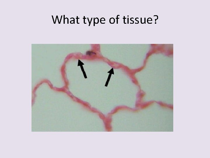 What type of tissue? 