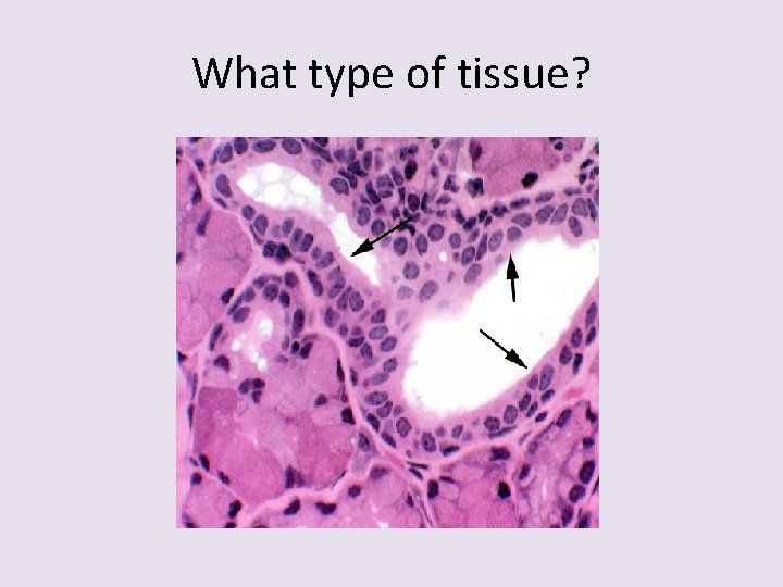 What type of tissue? 