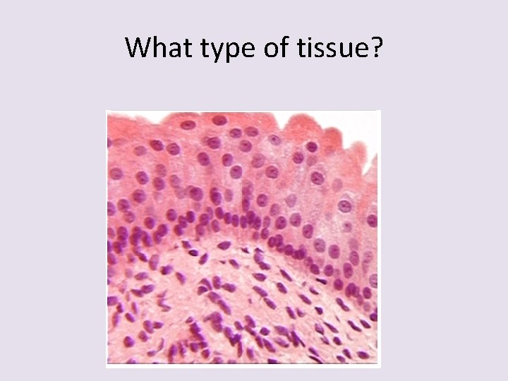 What type of tissue? 