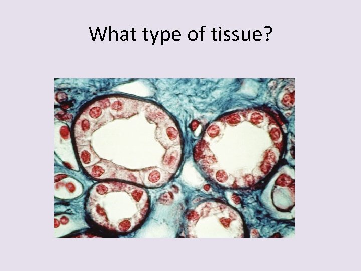 What type of tissue? 