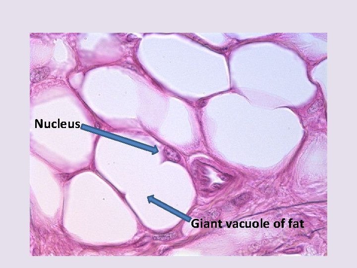 Nucleus Giant vacuole of fat 