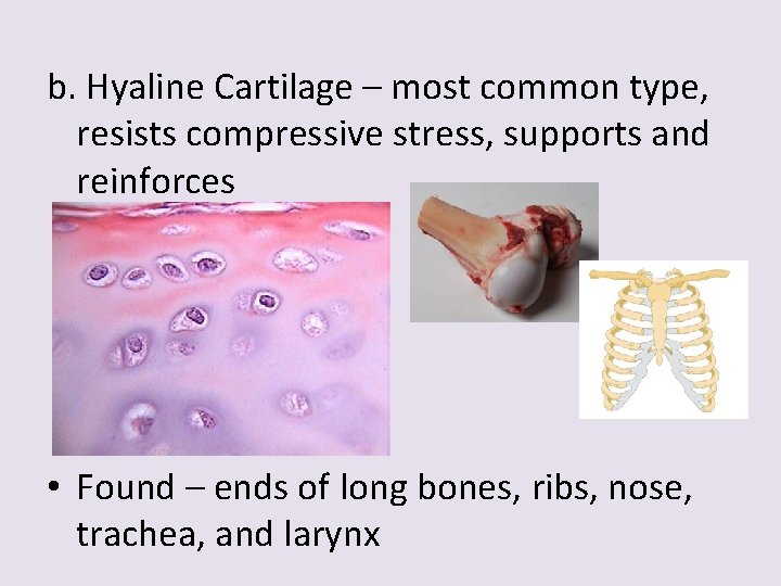 b. Hyaline Cartilage – most common type, resists compressive stress, supports and reinforces •