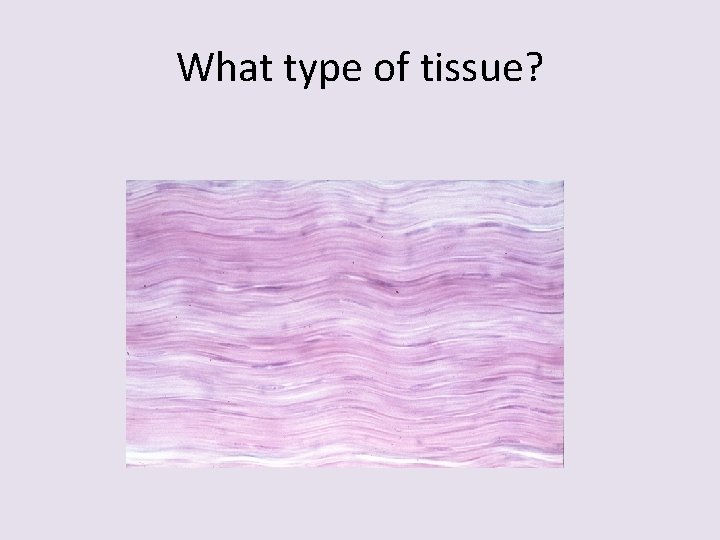 What type of tissue? 