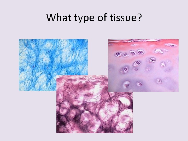 What type of tissue? 