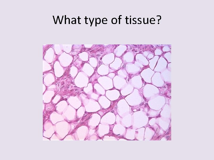 What type of tissue? 