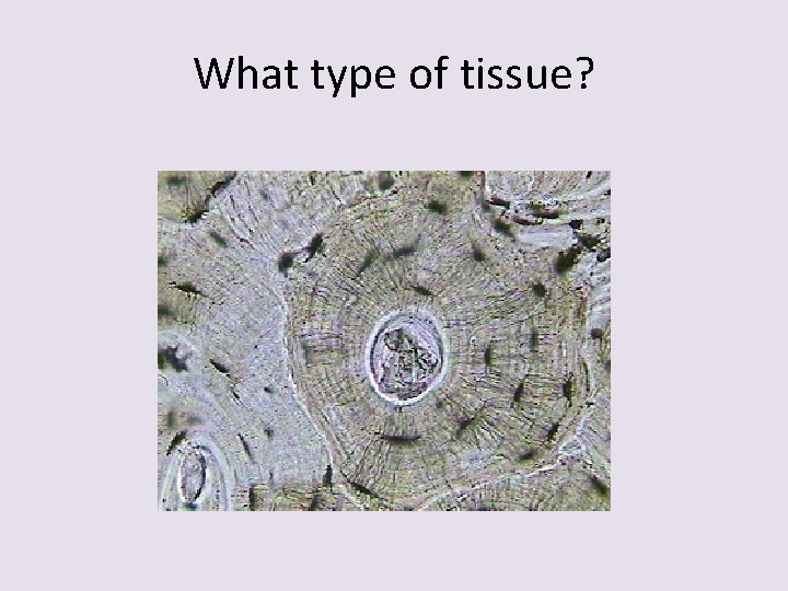 What type of tissue? 