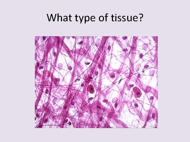 What type of tissue? 