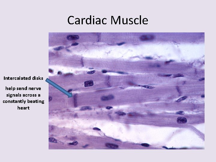 Cardiac Muscle Intercalated disks help send nerve signals across a constantly beating heart 