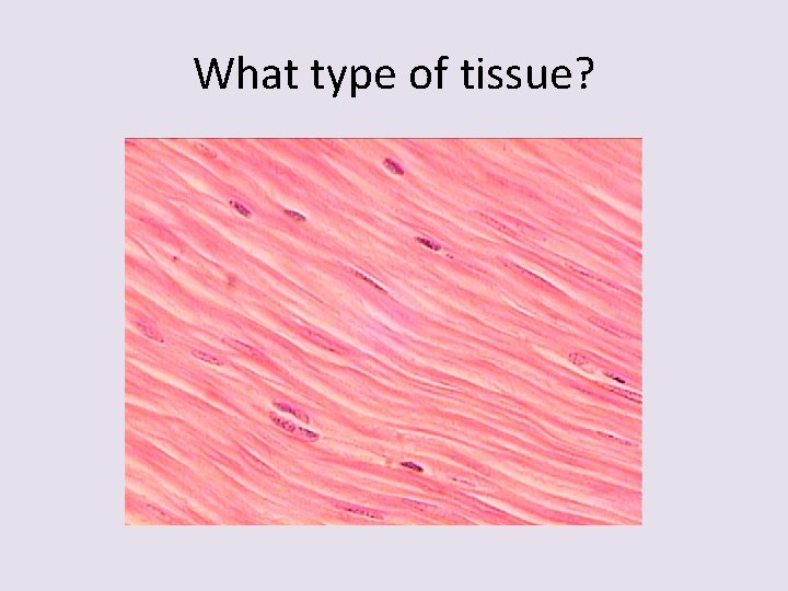 What type of tissue? 