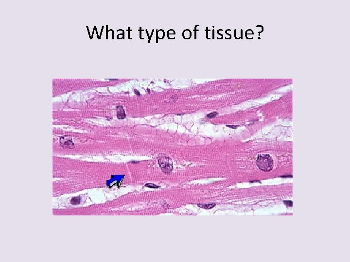 What type of tissue? 