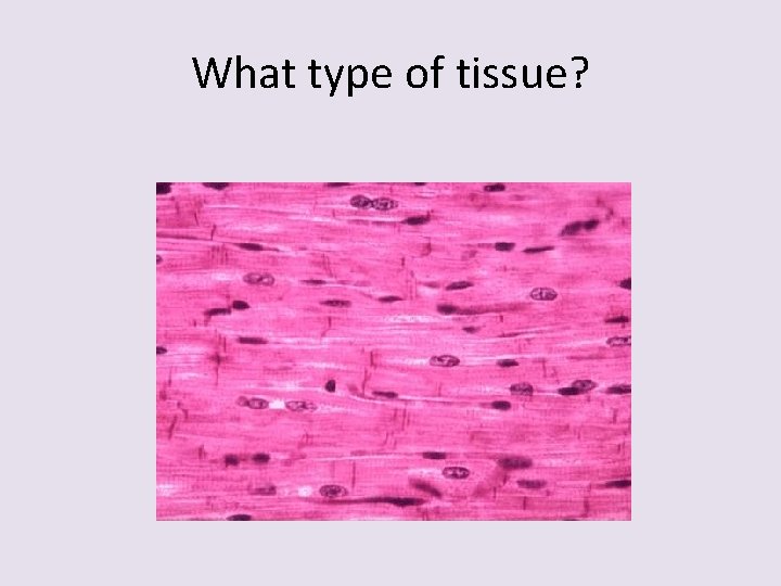 What type of tissue? 