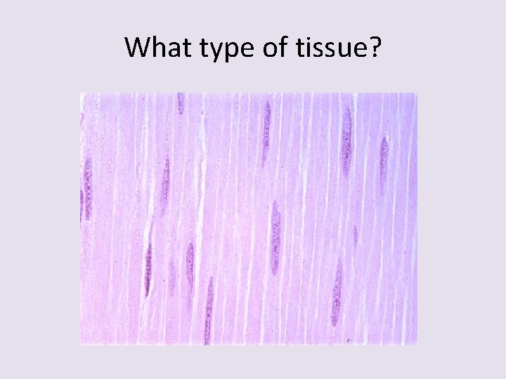 What type of tissue? 