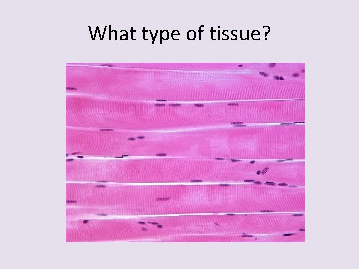 What type of tissue? 