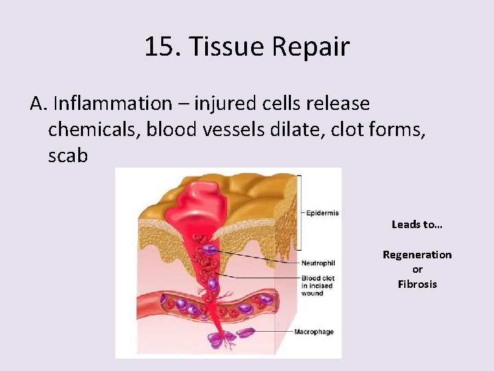 15. Tissue Repair A. Inflammation – injured cells release chemicals, blood vessels dilate, clot