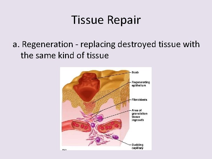 Tissue Repair a. Regeneration - replacing destroyed tissue with the same kind of tissue