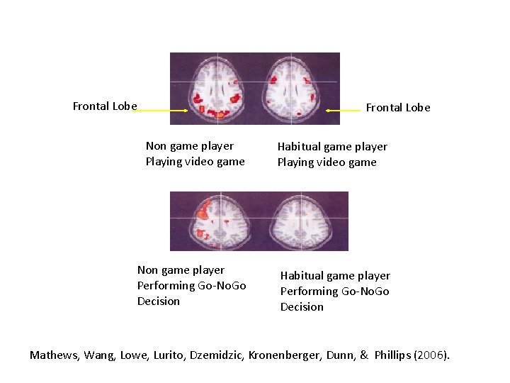 Frontal Lobe Non game player Playing video game Habitual game player Playing video game