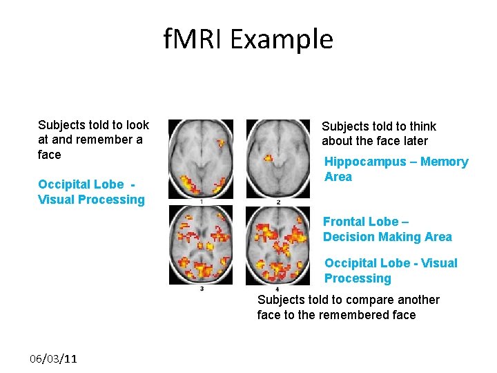 f. MRI Example Subjects told to look at and remember a face Occipital Lobe
