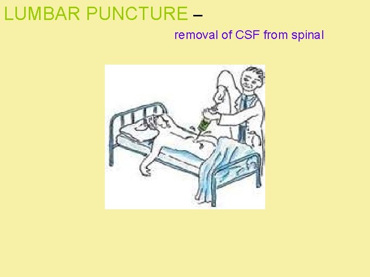 LUMBAR PUNCTURE – removal of CSF from spinal 