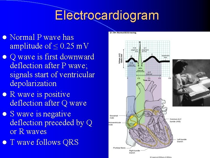 Electrocardiogram l l l Normal P wave has amplitude of ≤ 0. 25 m.