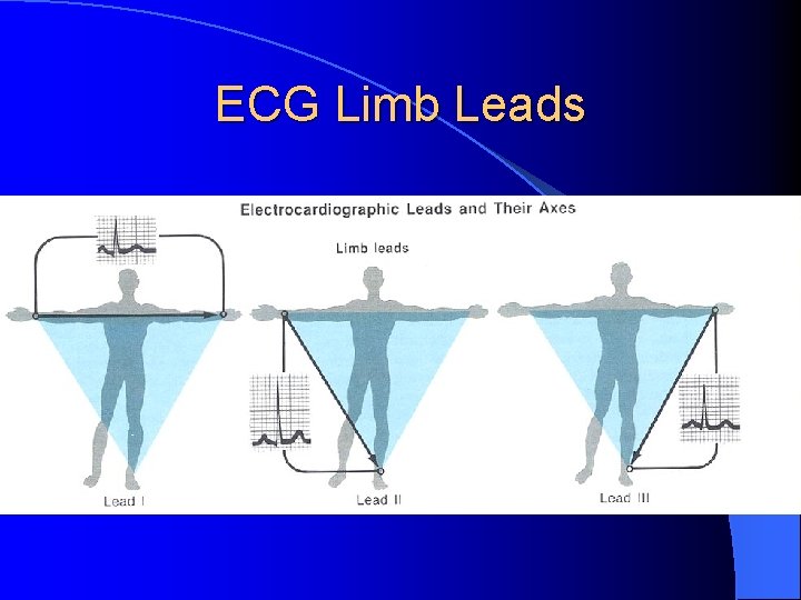ECG Limb Leads 